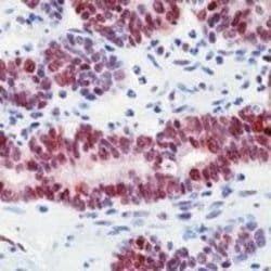 MGMT Monoclonal Antibody (MT 3.1), Invitrogen 500 &mu;L; Unconjugated:Antibodies,