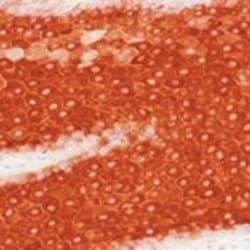 Cytokeratin 16 Monoclonal Antibody (LL025), Invitrogen 500 &mu;L | Buy Online | Invitrogen | Fisher Scientific