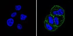 Invitrogen INSR alpha Monoclonal Antibody (83-14) 500 &mu;L; Unconjugated:Antibodies,