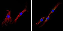 Invitrogen INSR Monoclonal Antibody (CT-3) 500 &mu;L; Unconjugated:Antibodies,