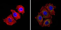 Invitrogen INSR Monoclonal Antibody (CT-3) 500 &mu;L; Unconjugated:Antibodies,