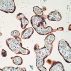 Invitrogen INSR Monoclonal Antibody (CT-3) 500 &mu;L; Unconjugated:Antibodies,