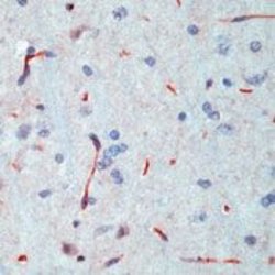 Invitrogen INSR Monoclonal Antibody (CT-3) 500 &mu;L; Unconjugated:Antibodies,