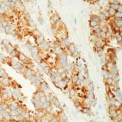 Invitrogen™ MVP Monoclonal Antibody (1032)
