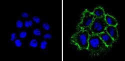 EpCAM Monoclonal Antibody (AUA1), Invitrogen 500 &mu;L; Unconjugated:Antibodies,