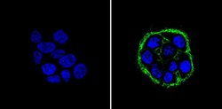 EpCAM Monoclonal Antibody (AUA1), Invitrogen 500 &mu;L; Unconjugated:Antibodies,