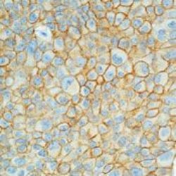 EpCAM Monoclonal Antibody (AUA1), Invitrogen 500 &mu;L; Unconjugated:Antibodies,