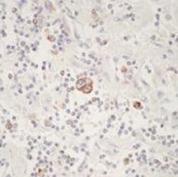 Bax Monoclonal Antibody (2D2), Biotin, Invitrogen 500 &mu;L; Biotin:Antibodies,