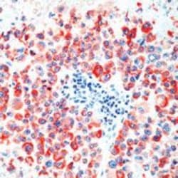 Invitrogen Tyrosinase Monoclonal Antibody (T311) 500 &mu;L; Unconjugated:Antibodies,