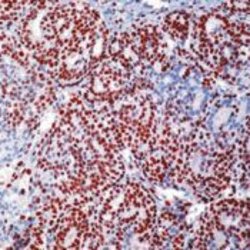 MCM7 Monoclonal Antibody (47DC141 (DCS-141)), Invitrogen 500 &mu;L; Unconjugated:Antibodies,