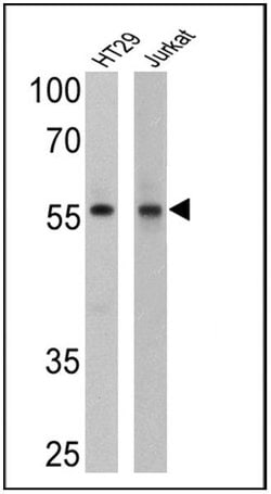 Cyclin B1 Monoclonal Antibody (GNS11), Invitrogen 500 &mu;L; Unconjugated:Antibodies,