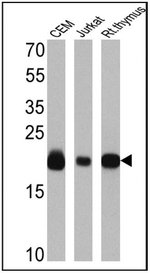 CD3/CD20 Antibody Cocktail, Invitrogen™