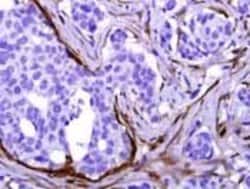 Calponin 1 Monoclonal Antibody (EP798Y), Invitrogen 1 mL; Unconjugated:Antibodies,