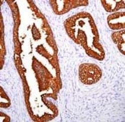 PSA Monoclonal Antibody (EP1588Y), Invitrogen 1 mL; Unconjugated:Antibodies,