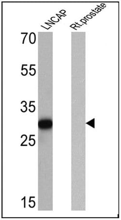 PSA Monoclonal Antibody (EP1588Y), Invitrogen 1 mL; Unconjugated:Antibodies,
