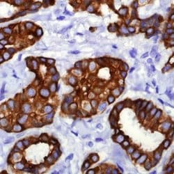 Cytokeratin 18 Monoclonal Antibody (E431-1), Invitrogen 1 mL; Unconjugated:Antibodies,