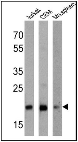 CD3e Monoclonal Antibody (EP449E), Invitrogen 1 mL; Unconjugated:Antibodies,