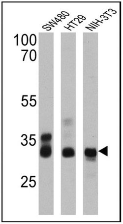 CDX2 Monoclonal Antibody (EPR2764Y), Invitrogen 1 mL; Unconjugated:Antibodies,