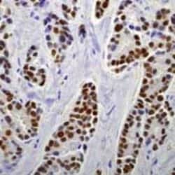 Invitrogen Estrogen Receptor alpha Monoclonal Antibody (SP1) 500 &mu;L;
