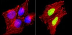 Invitrogen Cyclin D1 Recombinant Rabbit Monoclonal Antibody (SP4) 500 &mu;L;