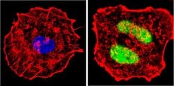 Invitrogen Cyclin D1 Recombinant Rabbit Monoclonal Antibody (SP4) 500 &mu;L;