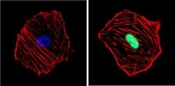 Invitrogen Cyclin D1 Recombinant Rabbit Monoclonal Antibody (SP4) 500 &mu;L;