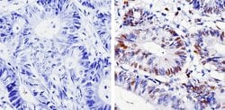 Invitrogen Cyclin D1 Recombinant Rabbit Monoclonal Antibody (SP4) 500 &mu;L;