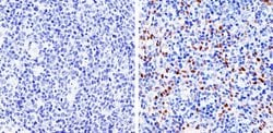 Invitrogen Cyclin D1 Recombinant Rabbit Monoclonal Antibody (SP4) 500 &mu;L;