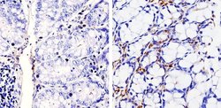 Invitrogen Cyclin D1 Recombinant Rabbit Monoclonal Antibody (SP4) 500 &mu;L;