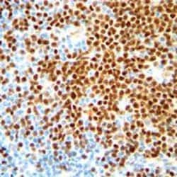 Invitrogen Cyclin D1 Recombinant Rabbit Monoclonal Antibody (SP4) 500 &mu;L;