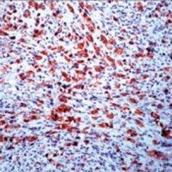 Invitrogen ALK Monoclonal Antibody (SP8) 500 &mu;L | Buy Online | Invitrogen&trade; | Fisher Scientific