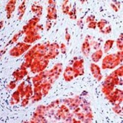 Invitrogen Calretinin Monoclonal Antibody (SP13) 500 &mu;L; Unconjugated:Antibodies,