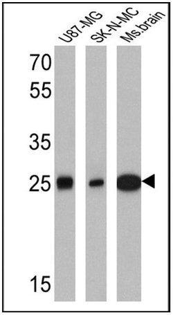 Invitrogen Calretinin Monoclonal Antibody (SP13) 500 &mu;L; Unconjugated:Antibodies,