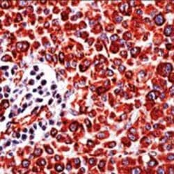 Vimentin Monoclonal Antibody (SP20), Invitrogen 500 &mu;L | Buy Online | Invitrogen | Fisher Scientific