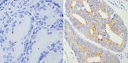 AMACR Monoclonal Antibody (13H4), Invitrogen 500 &mu;L; Unconjugated:Antibodies,