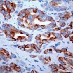 AMACR Monoclonal Antibody (13H4), Invitrogen 500 &mu;L; Unconjugated:Antibodies,
