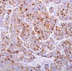 Invitrogen PSMA Recombinant Rabbit Monoclonal Antibody (SP29) 1 mL; Unconjugated:Antibodies,