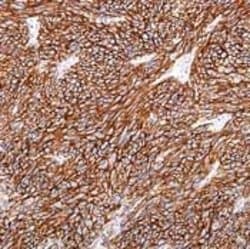 Invitrogen DOG-1 Recombinant Rabbit Monoclonal Antibody (SP31) 1 mL | Buy Online | Invitrogen&trade; | Fisher Scientific