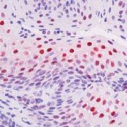 Phospho-c-Raf (Ser338) Monoclonal Antibody (pS338[DPR/2/2a/3a]), Invitrogen