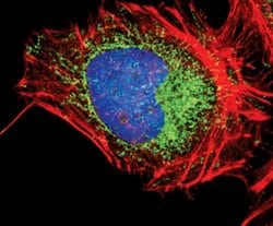 Invitrogen HK1 Monoclonal Antibody (R.457.3) 100 μL; Unconjugated:Antibodies,