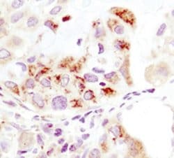 Invitrogen HK1 Monoclonal Antibody (R.457.3) 100 μL; Unconjugated:Antibodies,