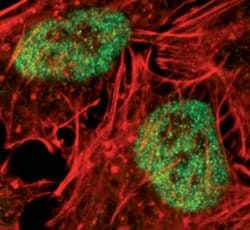Invitrogen JMJD1B Monoclonal Antibody (S.393.0) 100 &mu;L; Unconjugated:Antibodies,