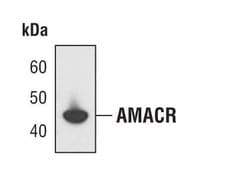 Invitrogen AMACR Monoclonal Antibody (R.16.1) 100 &mu;L; Unconjugated:Antibodies,