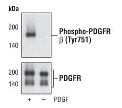 Invitrogen Phospho-PDGFRB (Tyr751) Monoclonal Antibody (G.13.6) 100 &mu;L;