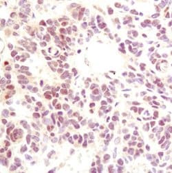 Invitrogen p35 Monoclonal Antibody (B.33.3) 100 &mu;L; Unconjugated:Antibodies,