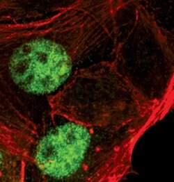 Invitrogen Progesterone Receptor Monoclonal Antibody (R.809.9) 100 &mu;L | Buy Online | Invitrogen&trade; | Fisher Scientific