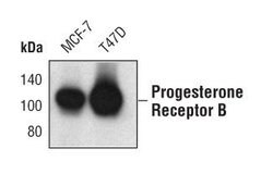 Invitrogen Progesterone Receptor Monoclonal Antibody (R.809.9) 100 &mu;L | Buy Online | Invitrogen&trade; | Fisher Scientific