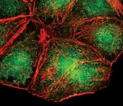 Invitrogen FOXO1 Monoclonal Antibody (S.502.4) 100 &mu;L; Unconjugated:Antibodies,