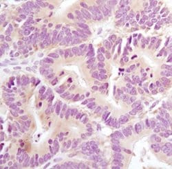 Invitrogen AXIN1 Monoclonal Antibody (K.53.7) 100 &mu;L; Unconjugated:Antikörper