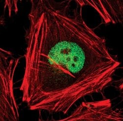 Invitrogen AP2 alpha Monoclonal Antibody (R.387.0) 100 &mu;L; Unconjugated:Antibodies,